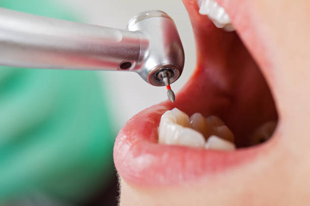 Best Walk-In Emergency Dentist in Carlinvle, IL